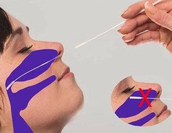 3ml NP Flocked Swab